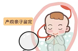 温州孕期如何做亲子鉴定，温州孕期亲子鉴定办理流程